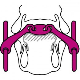 Sprenger KK Ultra double jointed loose ring bradoon 14mm